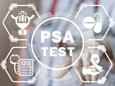 Here Is What You Need To Know About PSA Screenings