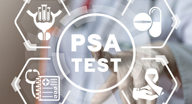 Here Is What You Need To Know About PSA Screenings