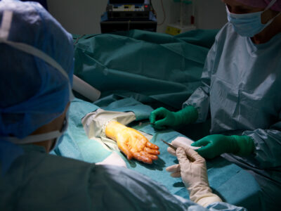 Common Surgeries For Treating Hand Pain