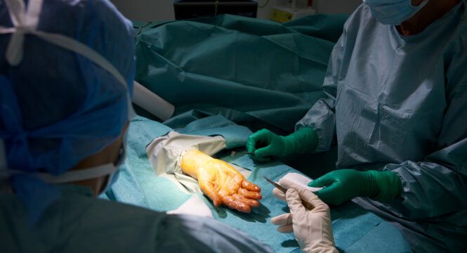 Common Surgeries For Treating Hand Pain