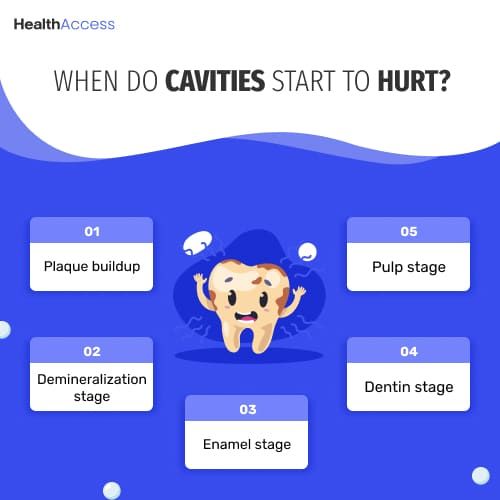 When Do Cavities Start to Hurt- details