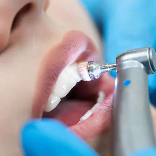 Dentist cleaning teeth