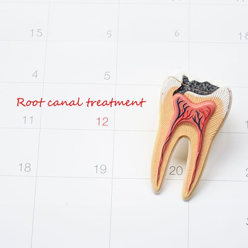 Teeth with RCT reprentation