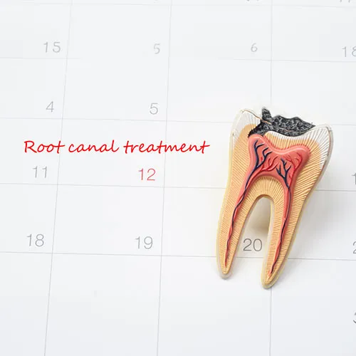 Teeth with RCT reprentation