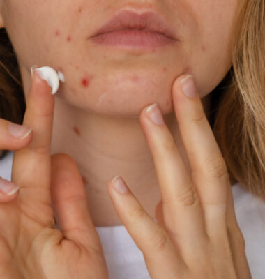 Reveal Your Best Skin: The Benefits of Incorporating Tretinoin into Your Daily Routine