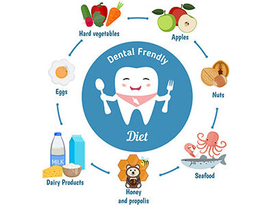 Tooth-Friendly Diet: 5 Best Foods for Promoting Dental Health