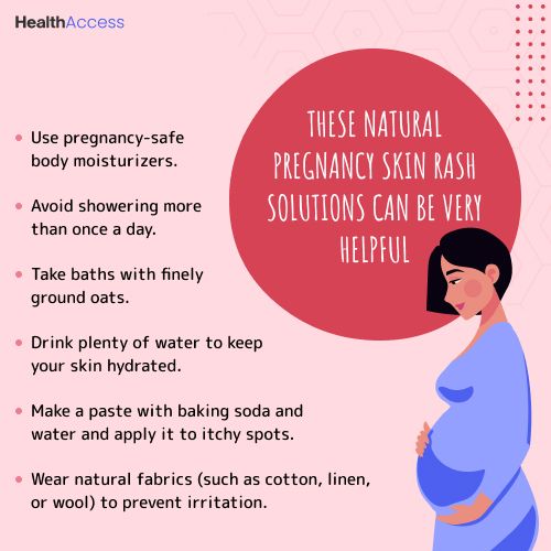 Infographic on Pregnancy rash