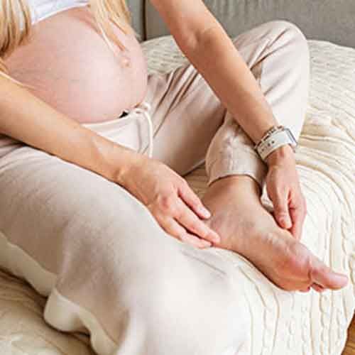 Pregnant women showing Vericose
