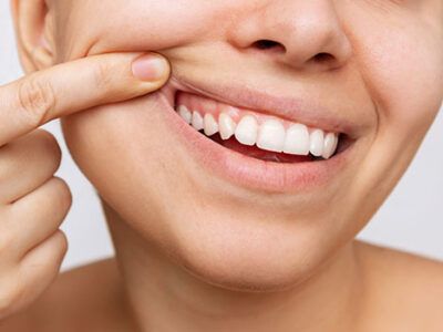 From Pearly Whites to Strong Gums: Here’s What Healthy Teeth Truly Look Like