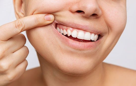 From Pearly Whites to Strong Gums: Here’s What Healthy Teeth Truly Look Like