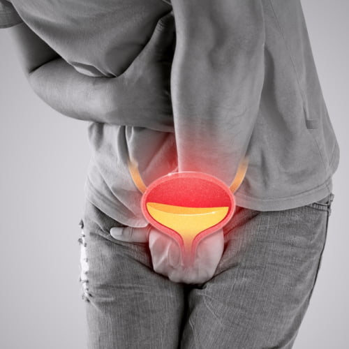 Man facing burning sensation on lower abdominal