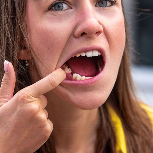 Women lost teeth